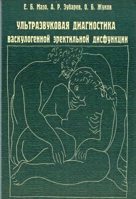 Ультразвуковая диагностика васкулогенной эректильной дисфункции