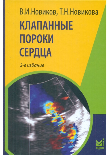 Клапанные пороки сердца