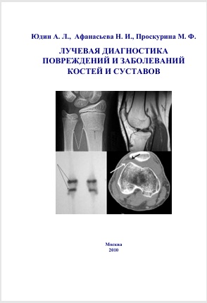Лучевая диагностика повреждений и заболеваний костей и суставов