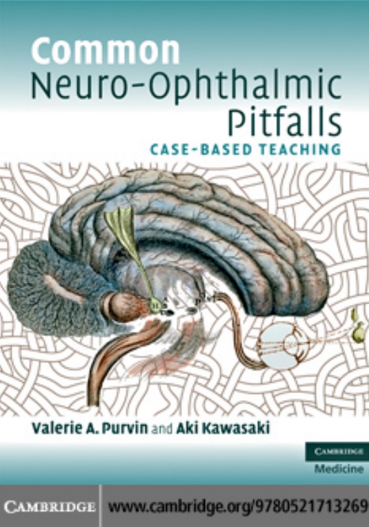 Common neuro-ophthalmic pitfalls