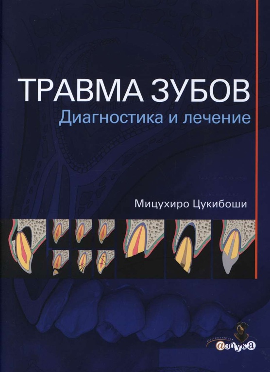 Травма зубов