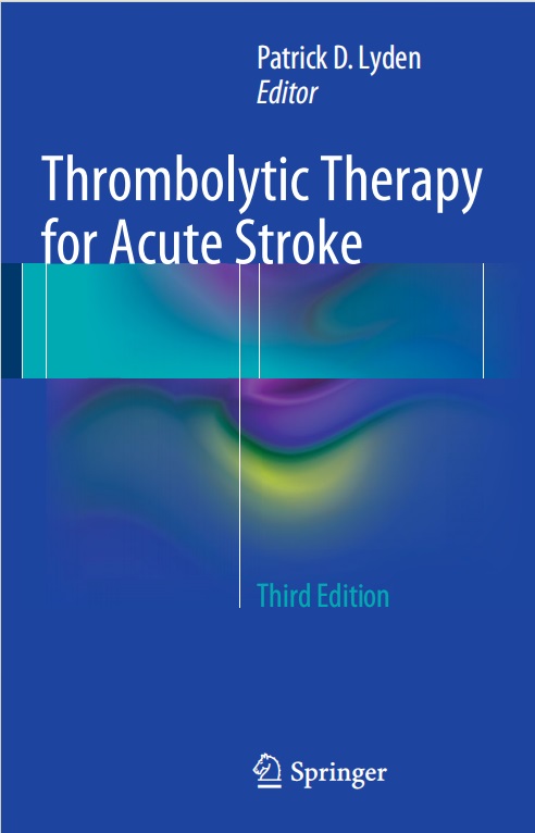Thrombolytic therapy for acute stroke