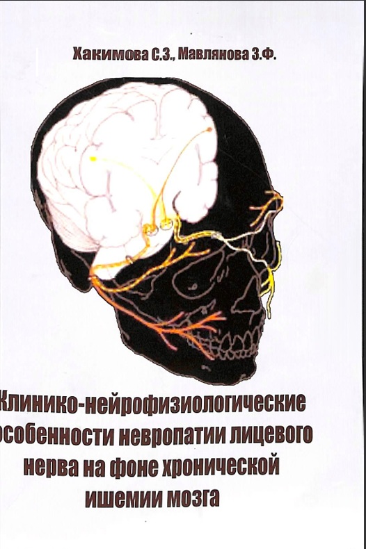 Клинико- нейрофизиологические особенности невропатии лицевого нерва на фоне хронической ишемии  мозга
