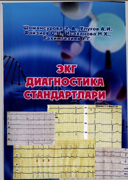 Экг диагностика стандартлари