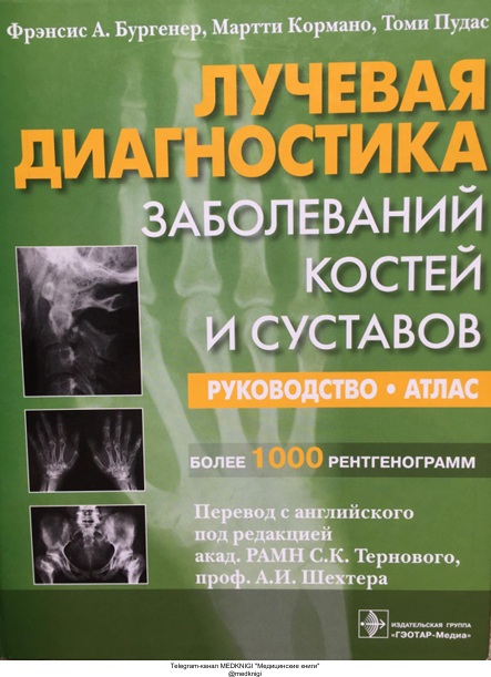 Лучевая диагностика заболеваний костей и суставов