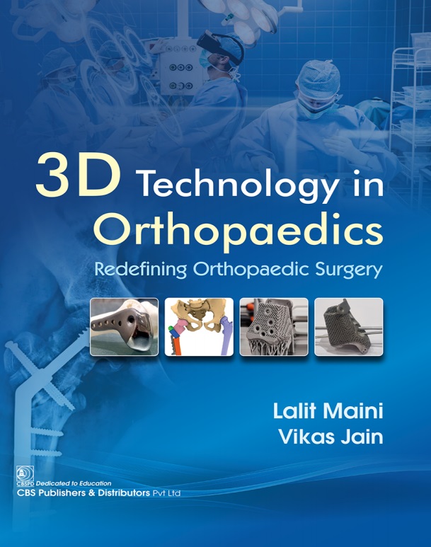 3D Technology in orthopaedics: redefining orthopaedic surgery