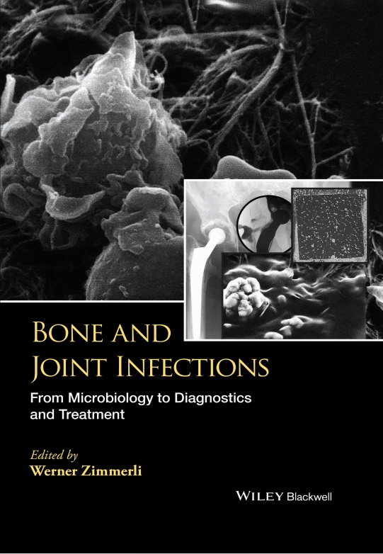 Bone and joint infections