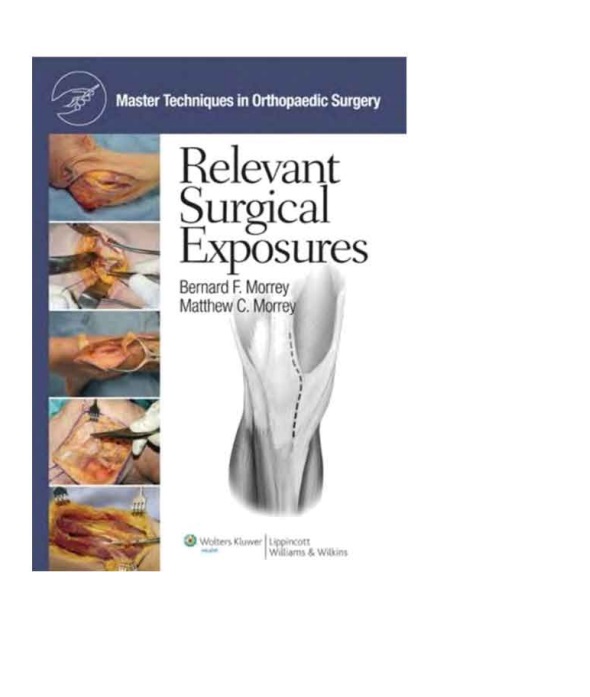 Master techniques in orthopaedic surgery: relevant surgical exposures
