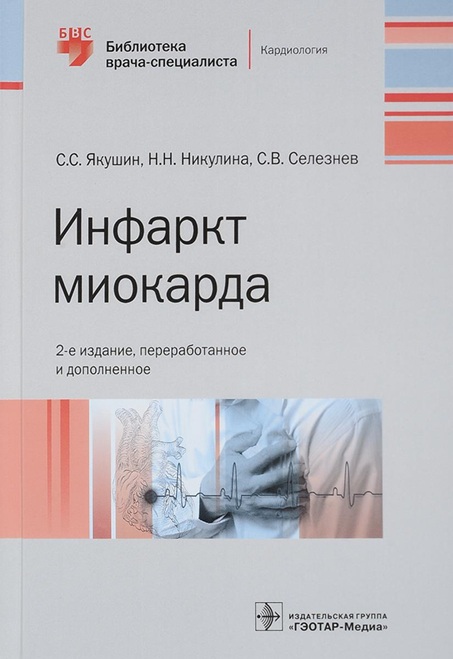 Инфаркт миокарда