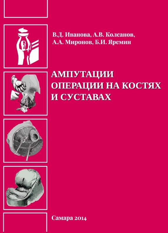 Ампутации. Операции на костях и суставах