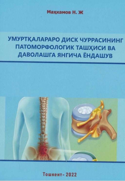 Умуртқалараро диск чуррасининг патоморфологик ташҳиси ва даволашга янгича ёндашув