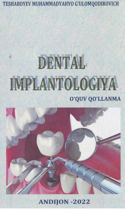 Dental imlantologiya