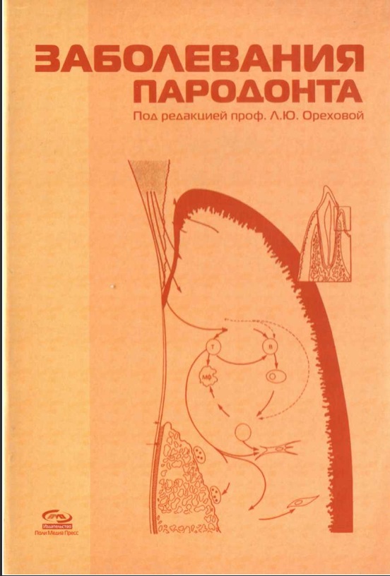 Заболевания пародонта