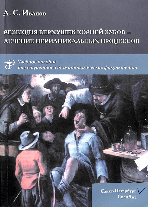 Резекция верхушек корней зубов — лечение периапикальных процессов