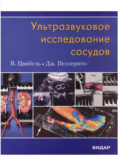 Ультразвуковое исследование сосудов