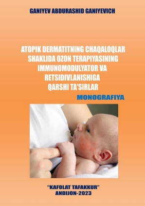 Atopik dermatitning chaqoloqlar shaklida ozon terapiyasining immunomodulyator va retsidivlanishiga qarshi ta'sirlar