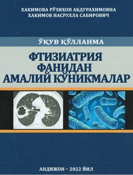 Фтизиатрия фанидан амалий куникмалар