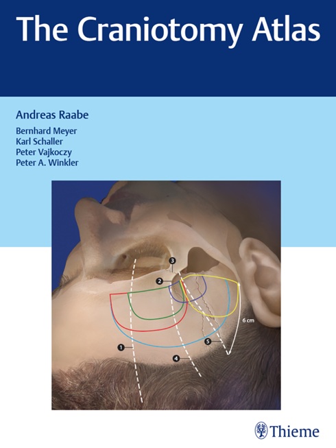 The craniotomy atlas