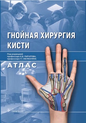 Гнойная хирургия кисти