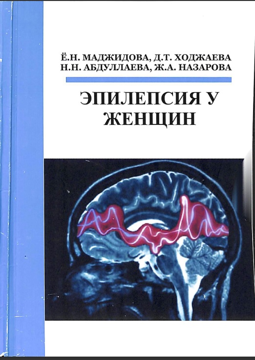 Эпилепсия у женщин