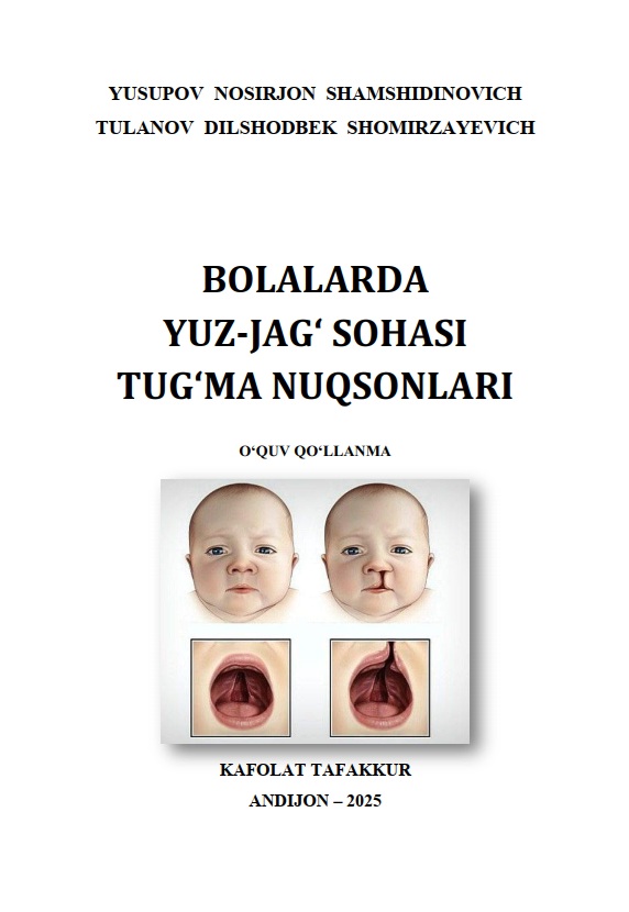 Bolalarda yuz-jag' sohasi tug'ma nuqsonlari
