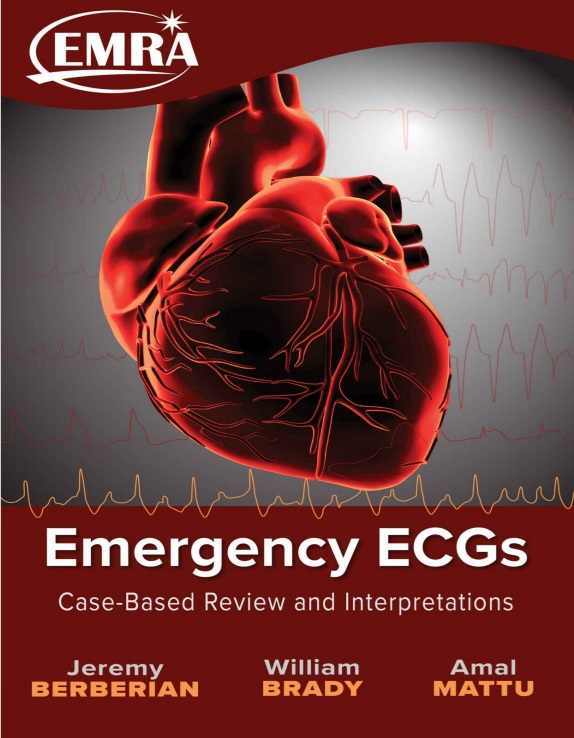 Emergency ECGs: case-based review and interpretations