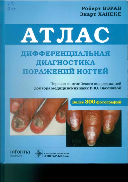 Атлас. Дифференциальная диагностика поражений ногтей