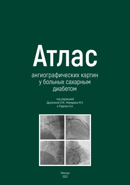Атлас ангиографических  картин  у больных сахарным   диабетом