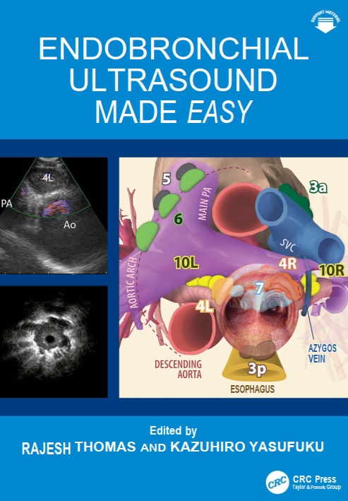 Endobronchial Ultrasound Made Easy