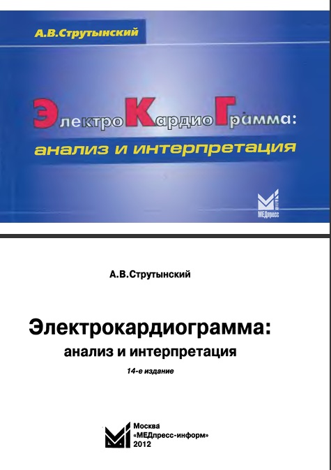 Электрокардиограмма анализ и интерпретация