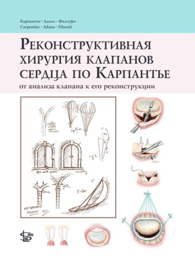 Реконструктивная хирургия клапанов сердца по карпантье от анализа клапана к его реконструкции