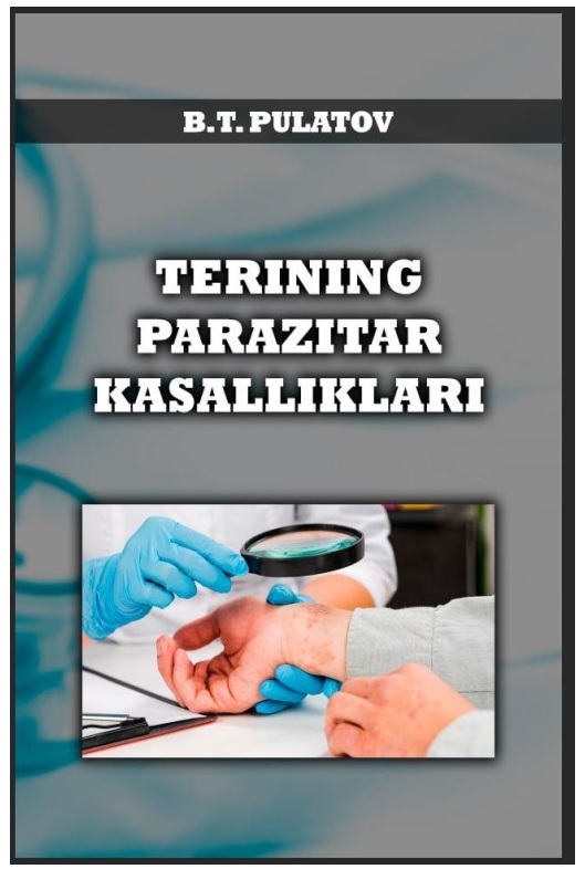 Terining parazitar kasalliklari