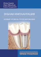 Зубная имплантация. Новый уровень протезирования