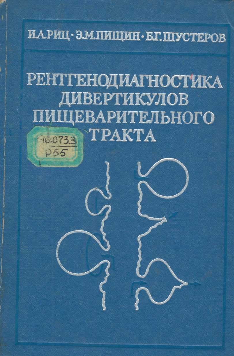 Рентгенодиагностика дивертикулов пищеварительного тракта