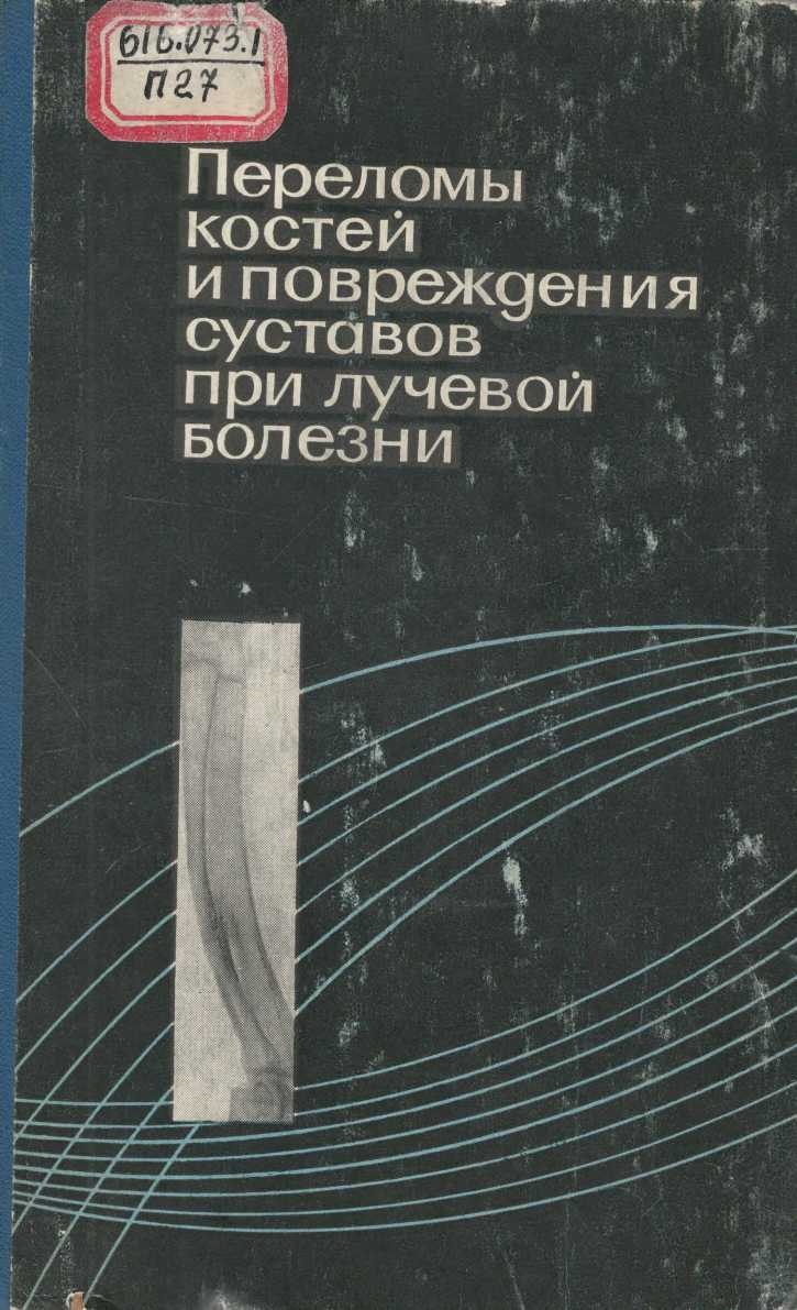 Переломы костей и повреждения суставов при лучевой болезни 